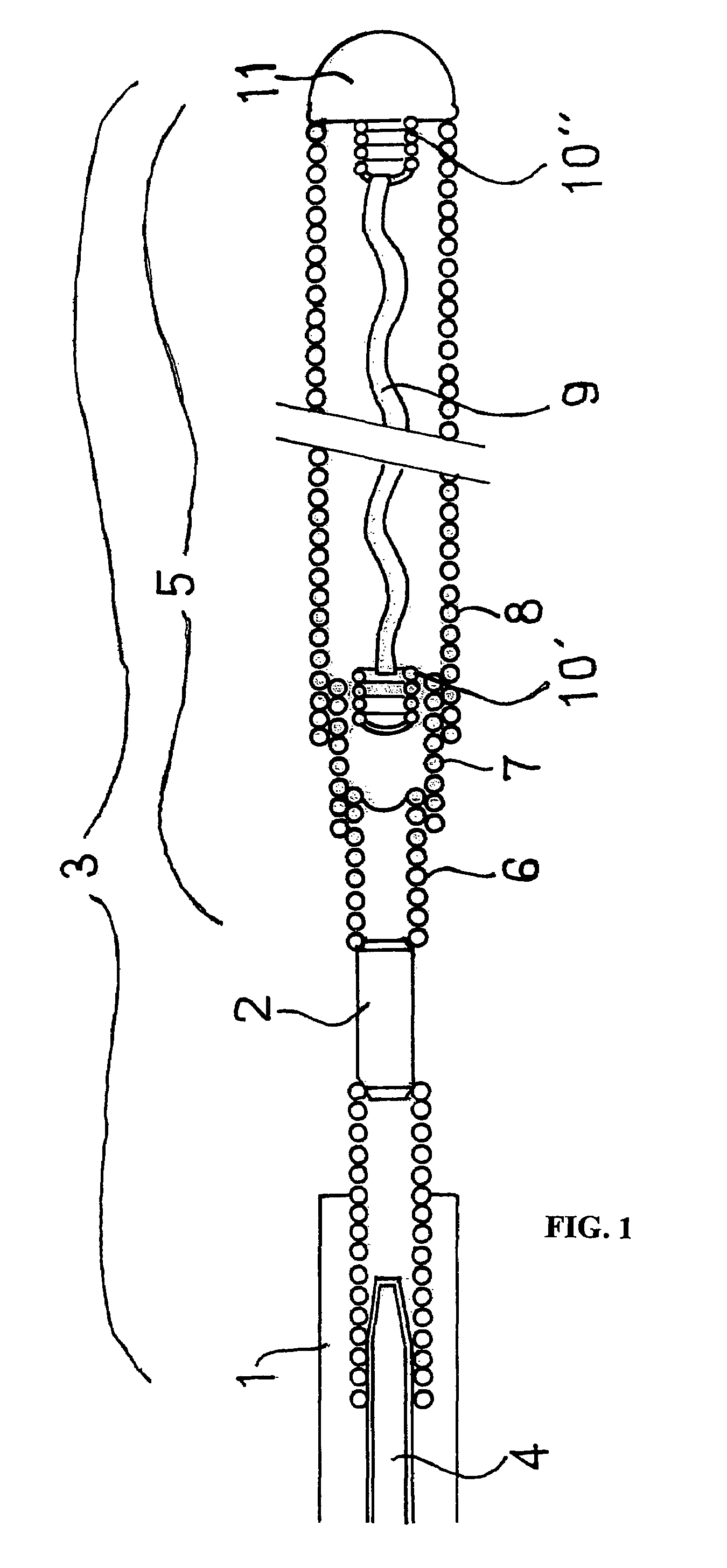 Device for implanting occlusion spirals