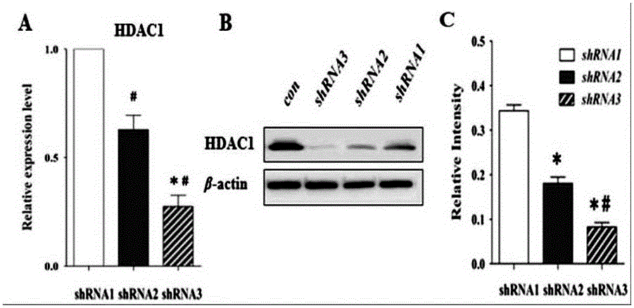 Synthesizing method and application for LV-HDAC1shRNA lentivirus of target silence HDAC1 gene
