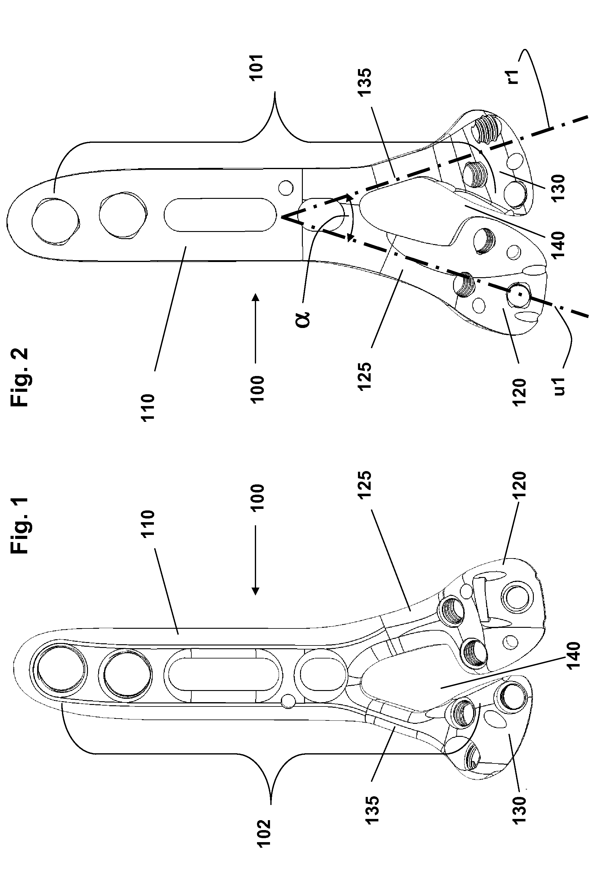 Fracture fixation plate, system and methods of use