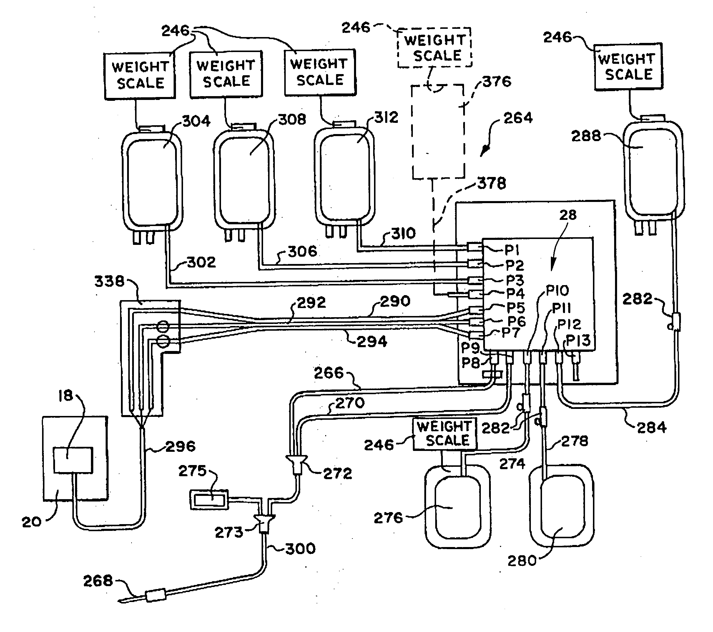 Fluid pressure actuated blood pumping systems and methods with continuous inflow and pulsatile outflow conditions