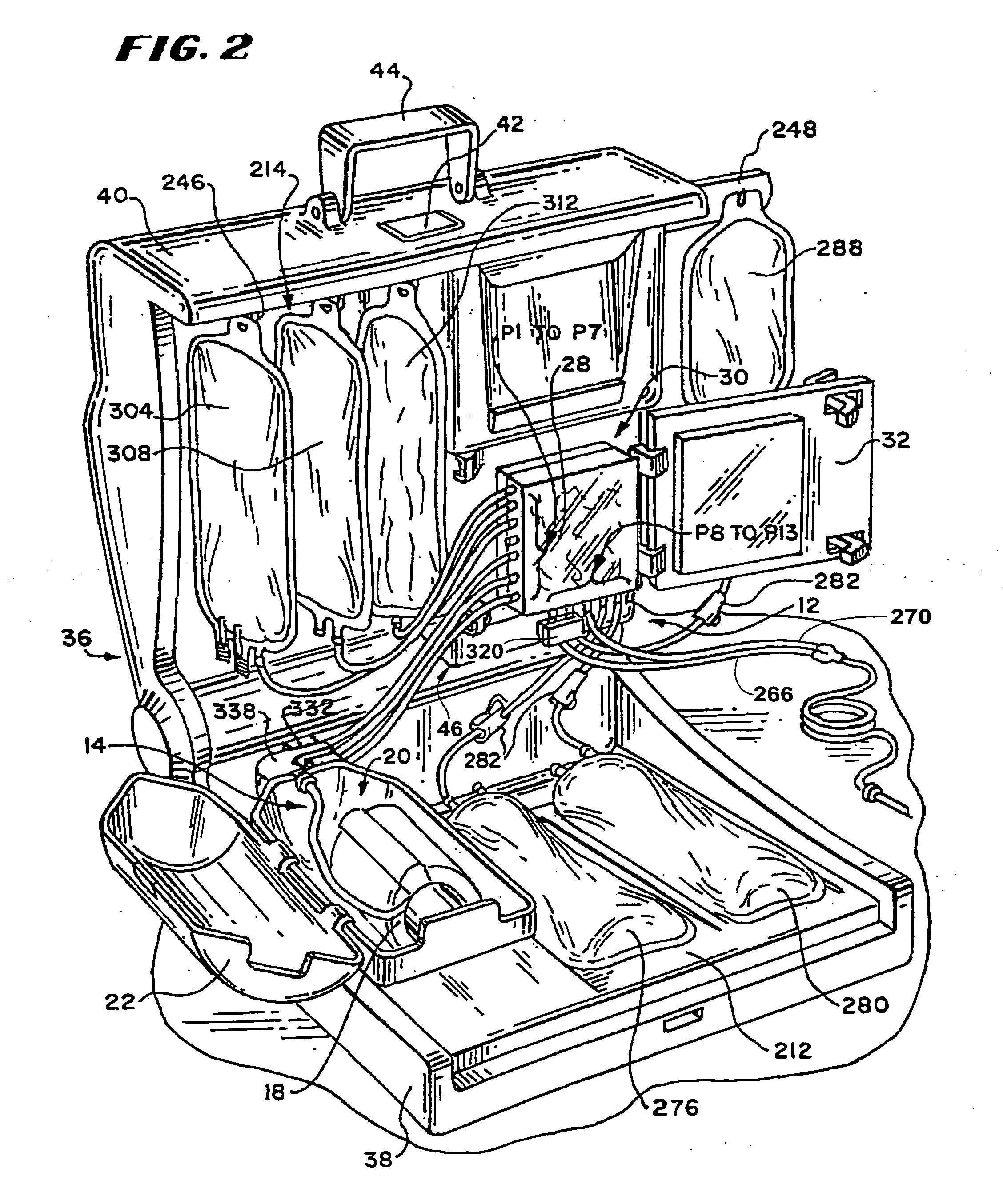 Fluid pressure actuated blood pumping systems and methods with continuous inflow and pulsatile outflow conditions