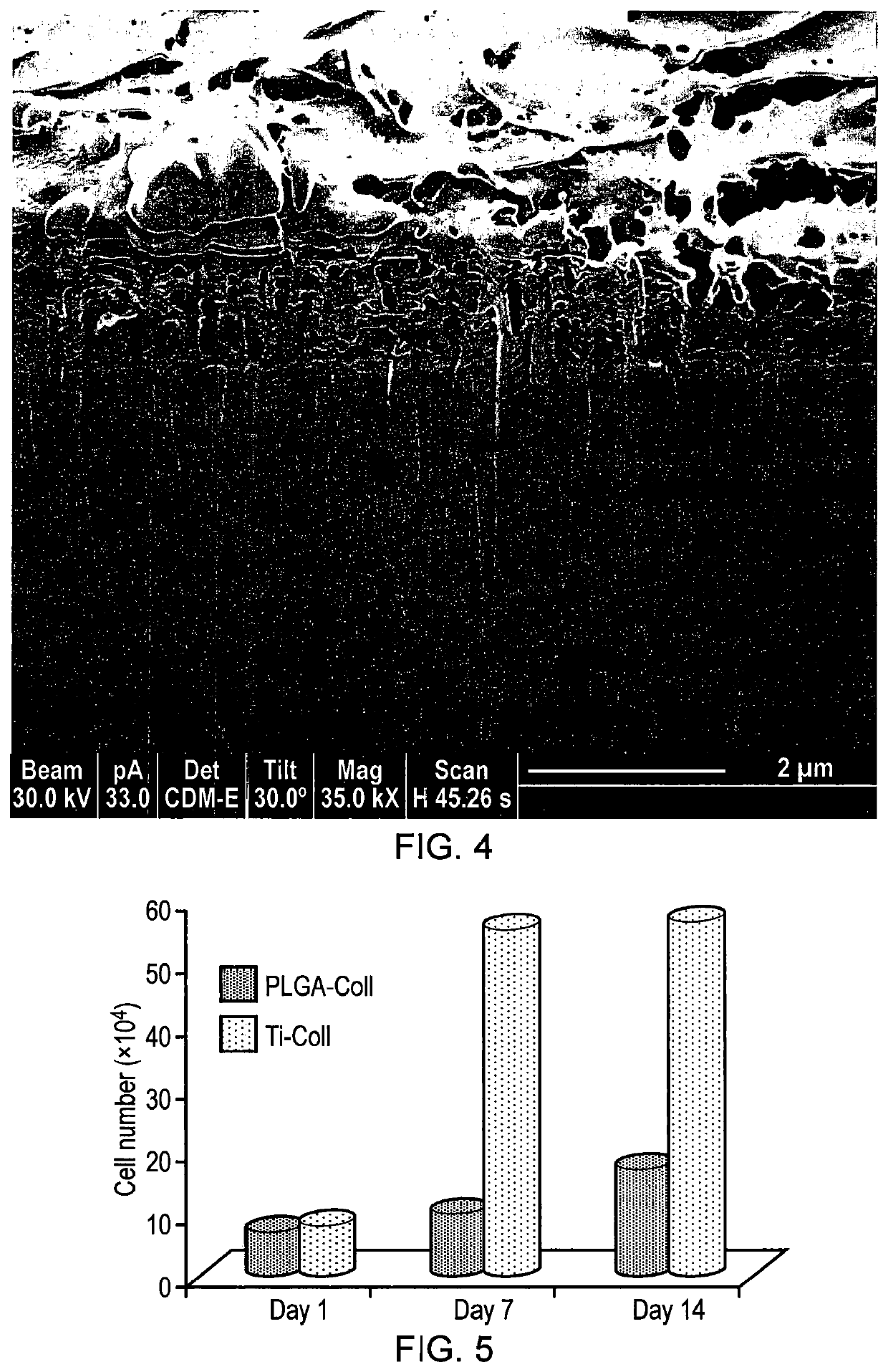 Osteochondral scaffold