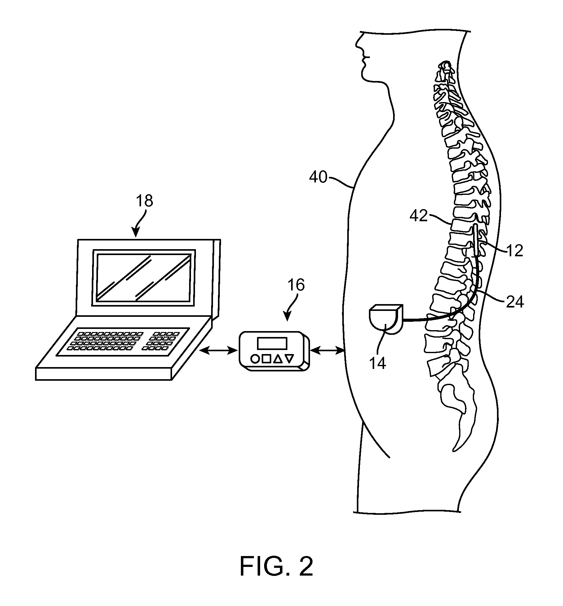 Method for selectively modulating neural elements in the dorsal horn