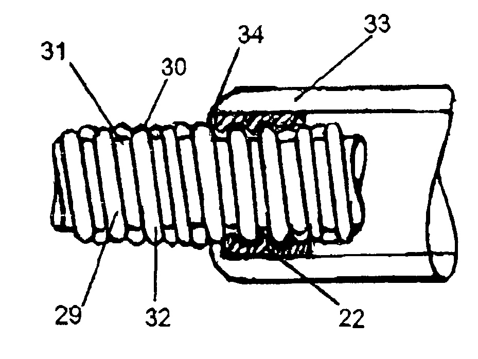 Method of forming a respiratory conduit
