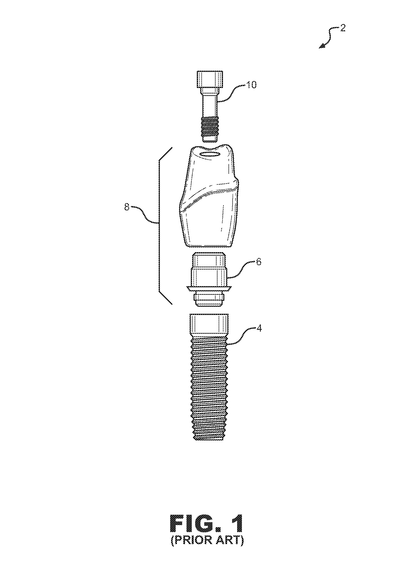 Dental implant system and method of use