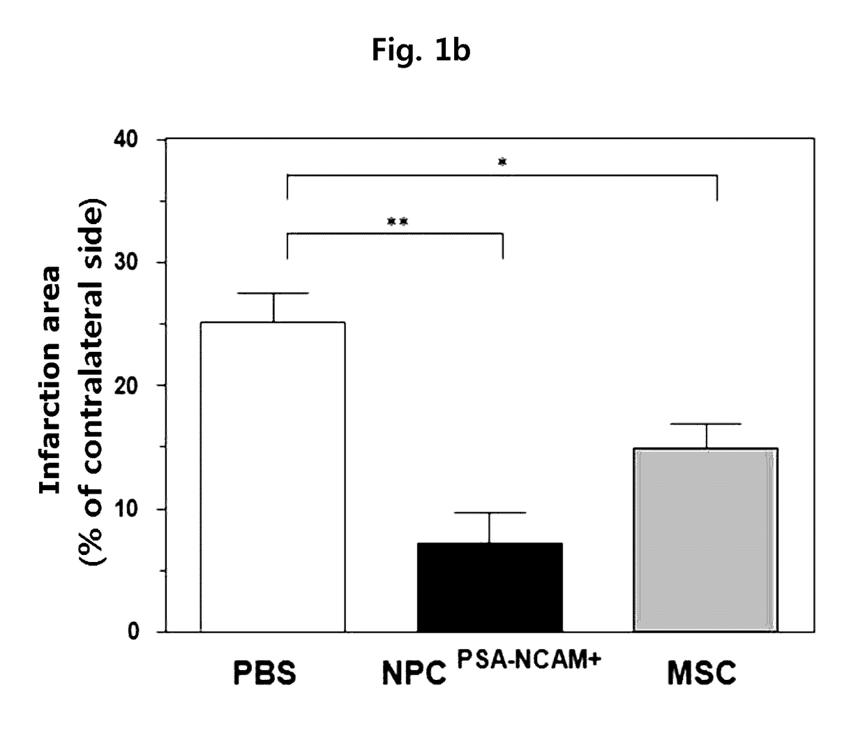 Composition for treating ischemic diseases or neuroinflammatory diseases containing neural progenitor cells or secretome thereof as active ingredient