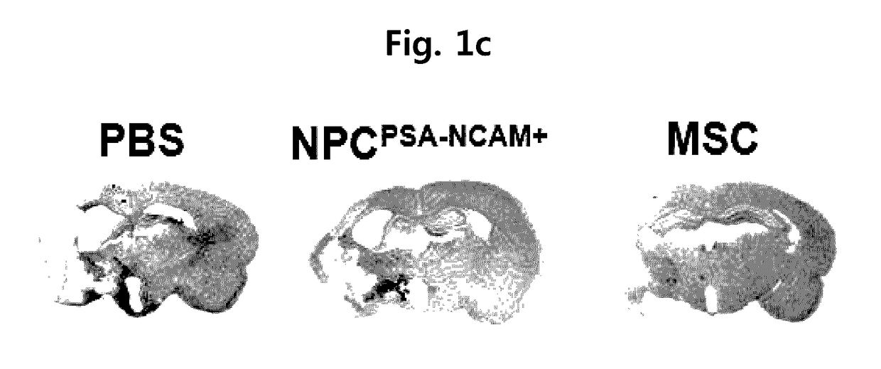 Composition for treating ischemic diseases or neuroinflammatory diseases containing neural progenitor cells or secretome thereof as active ingredient