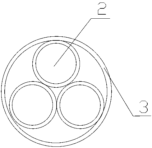 Preparation and application method of a glaucoma internal drainage substitute bionic stent