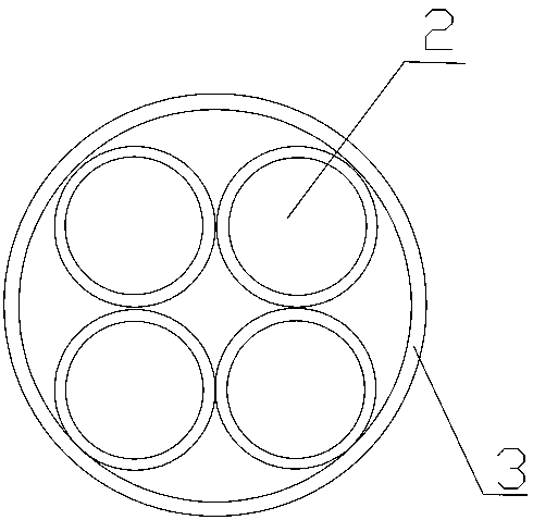 Preparation and application method of a glaucoma internal drainage substitute bionic stent