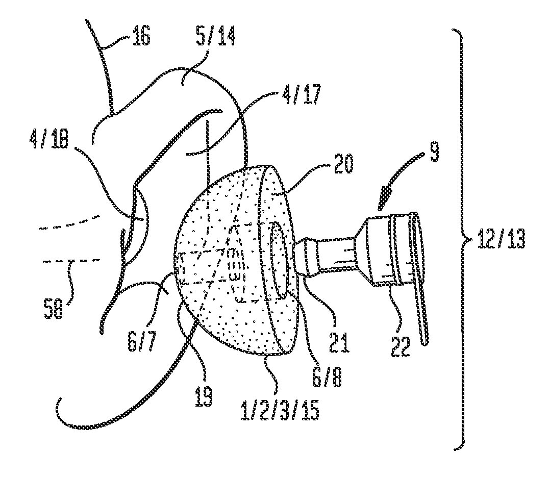 Moldable Earpiece System