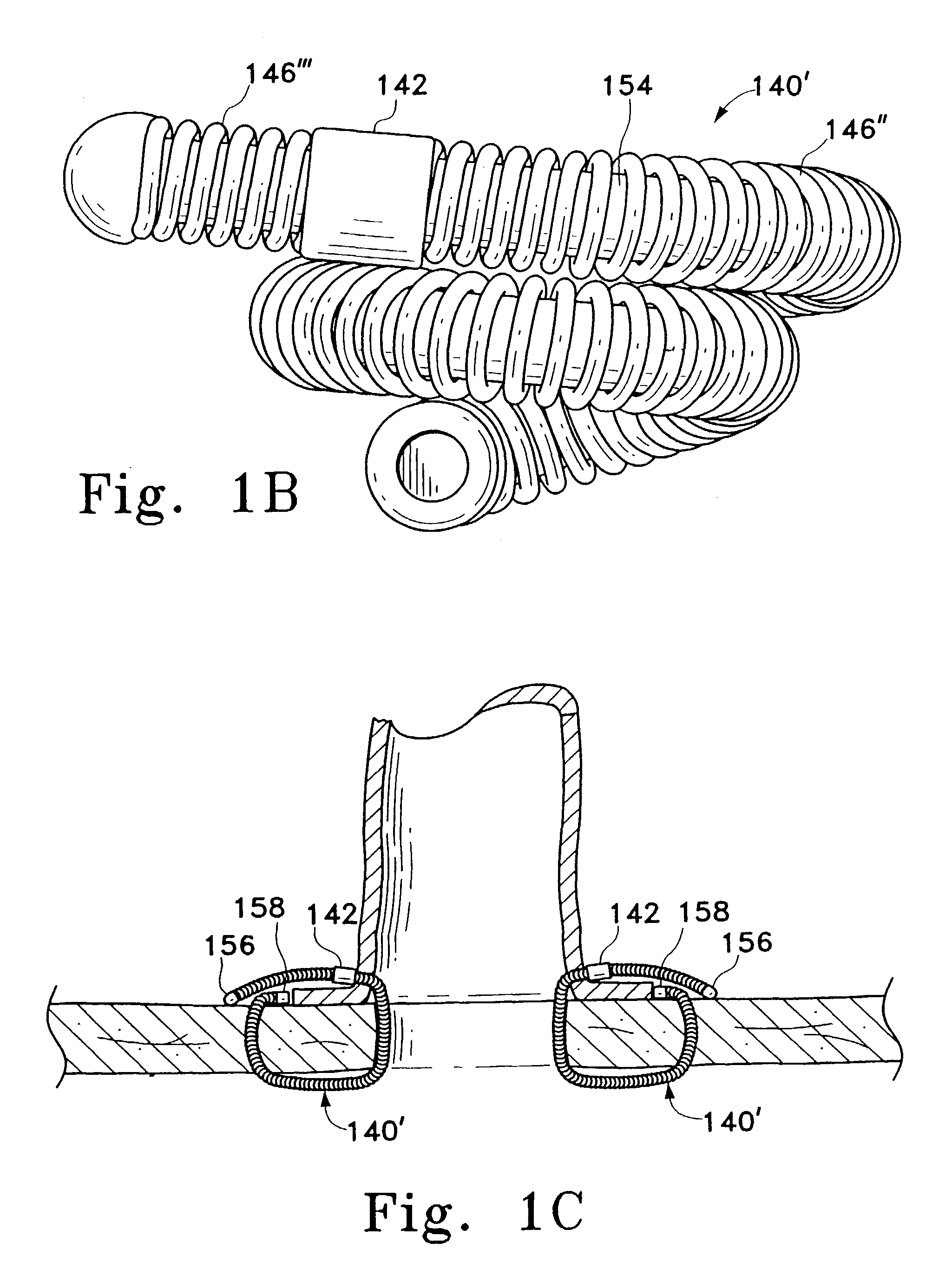 Multiple bias surgical fastener