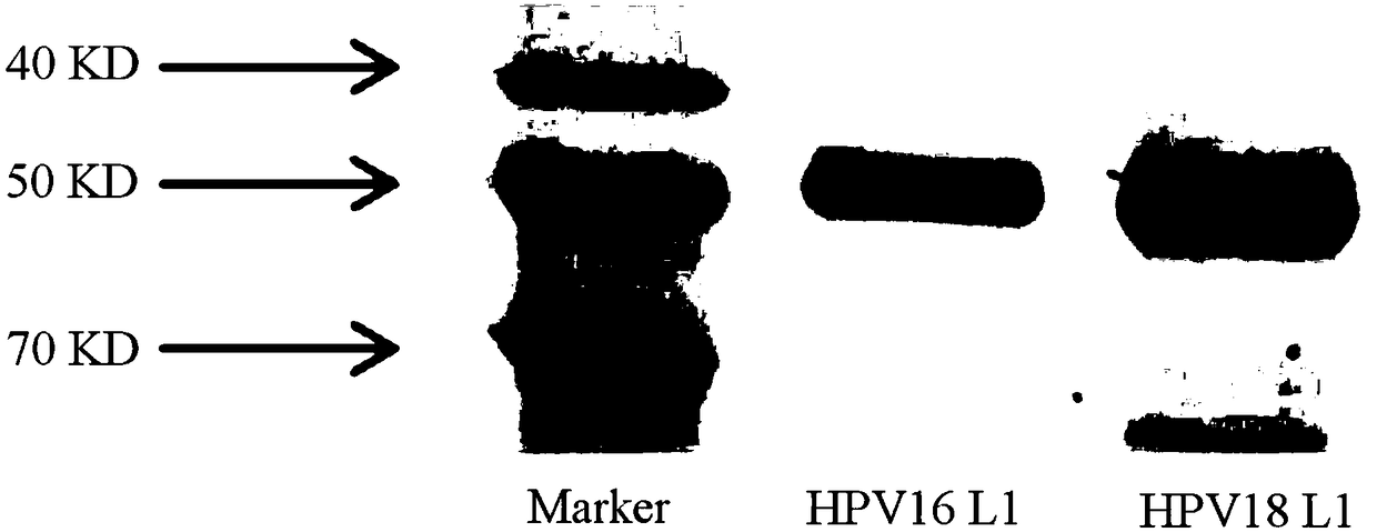 Test paper strip/test paper card for rapidly detecting HPV (Human Papilloma Virus) antibody by using double-antibody sandwich method and preparation method thereof