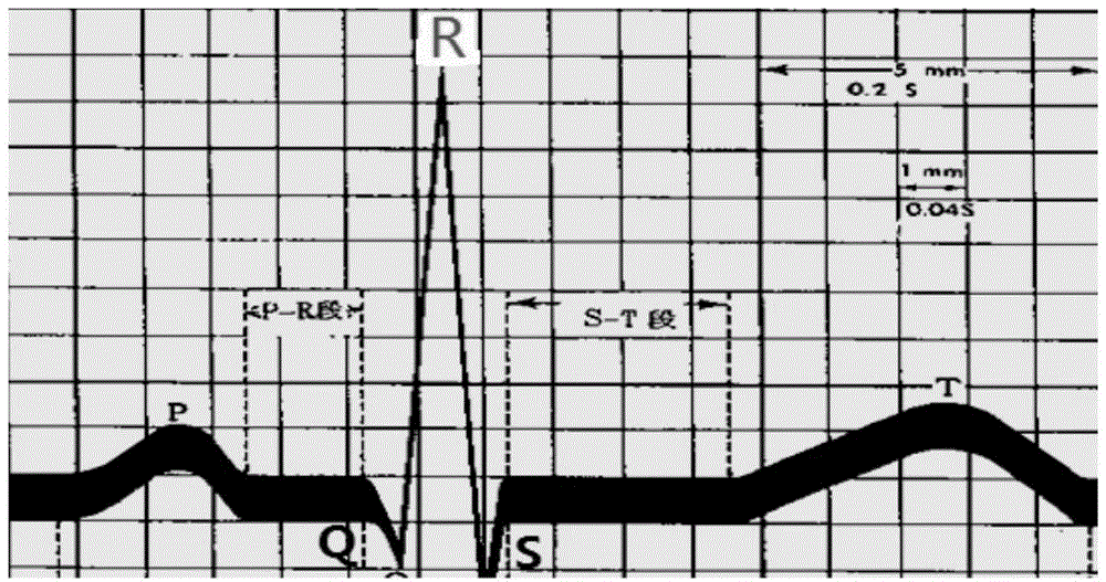 Electrocardiogram waveform classification method and device