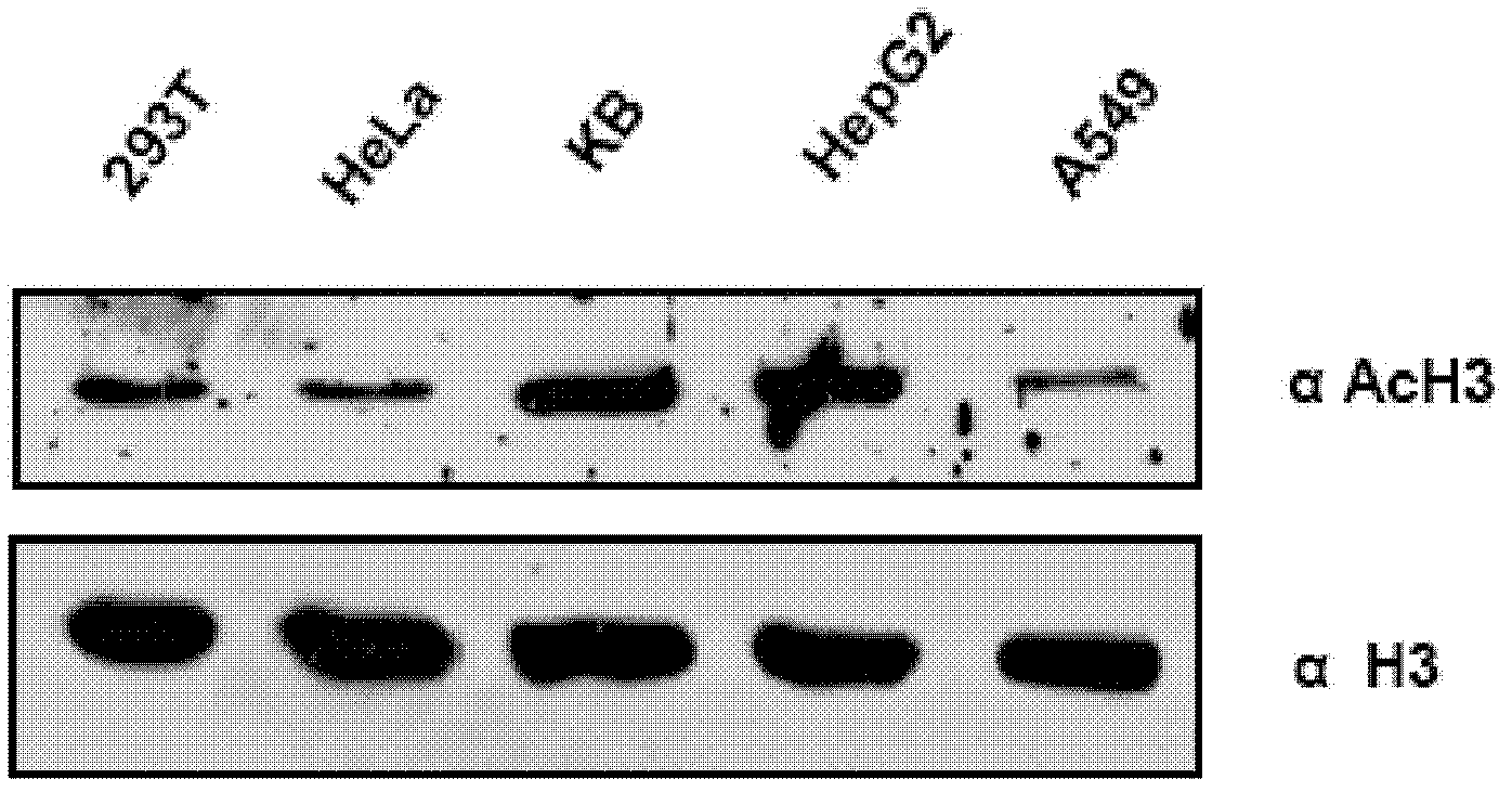 Inhibition of histone acetyltransferases by CTK7A and methods thereof