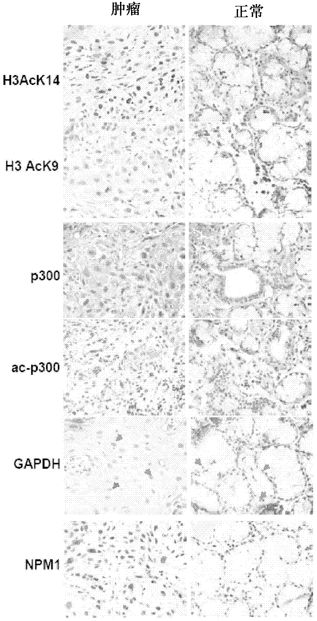 Inhibition of histone acetyltransferases by CTK7A and methods thereof