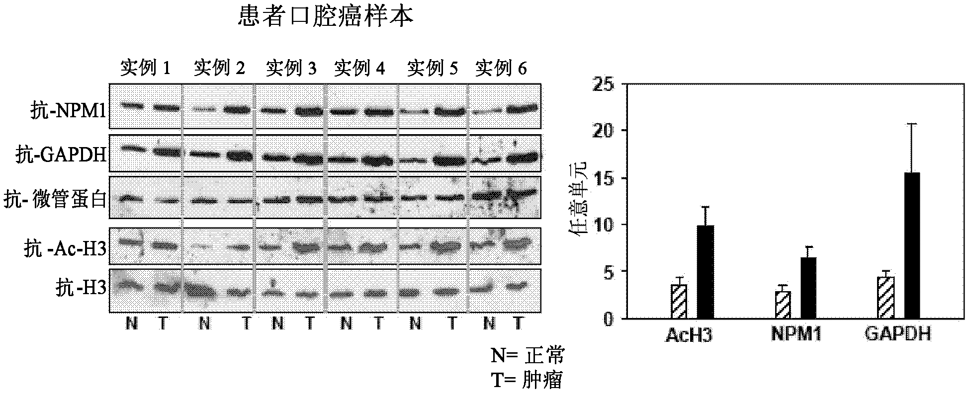 Inhibition of histone acetyltransferases by CTK7A and methods thereof