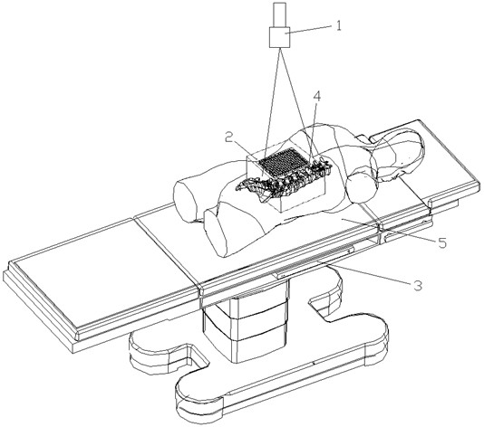 A fast positioning and tracking device for an auxiliary robot