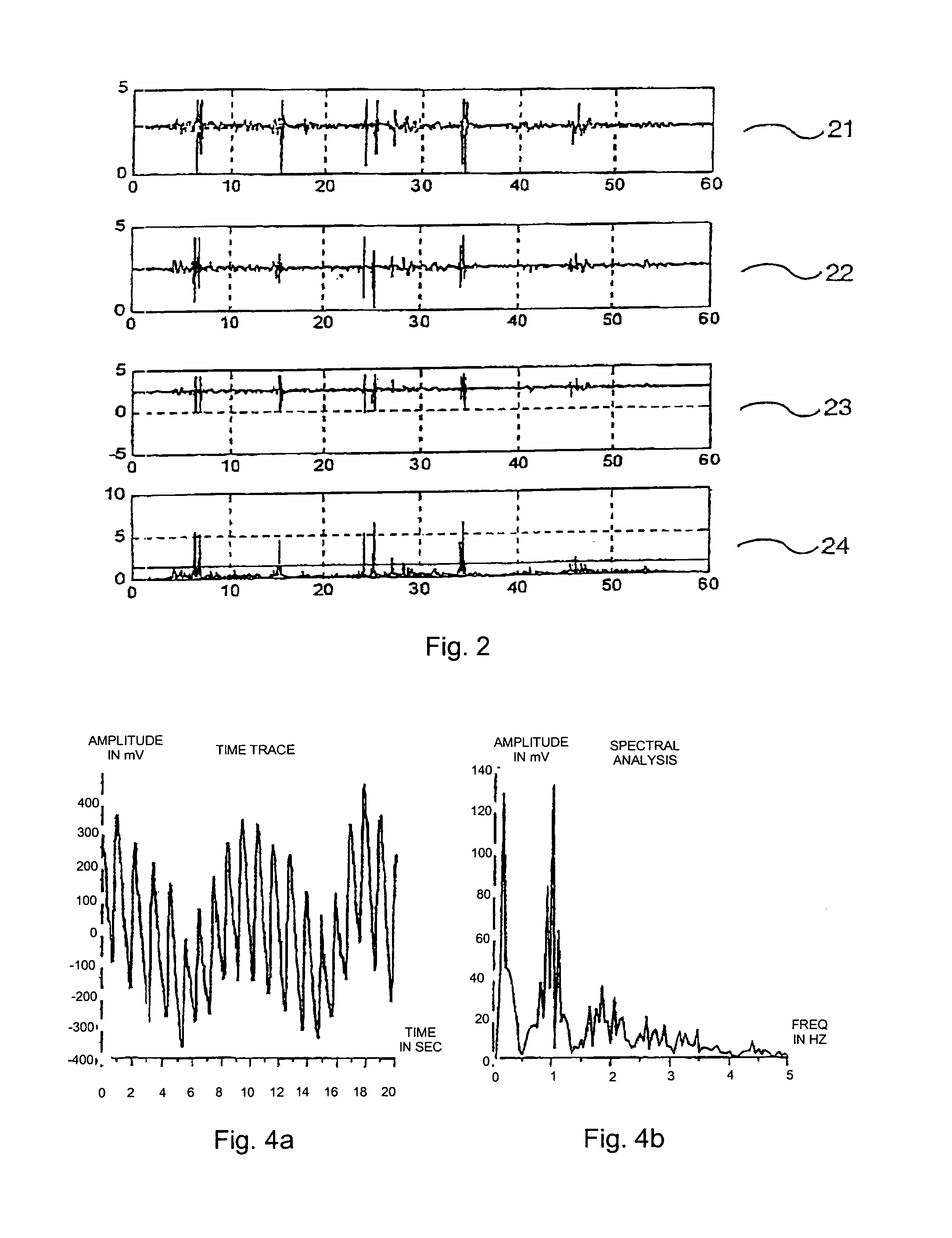 Device and method for detecting abnormal situations