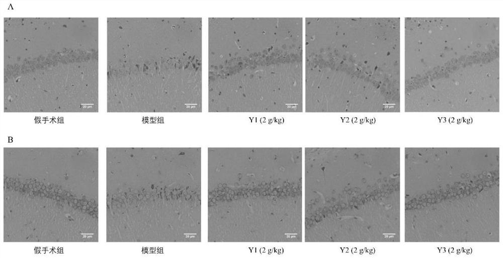 Pharmaceutical composition for improving cerebral ischemia and application thereof