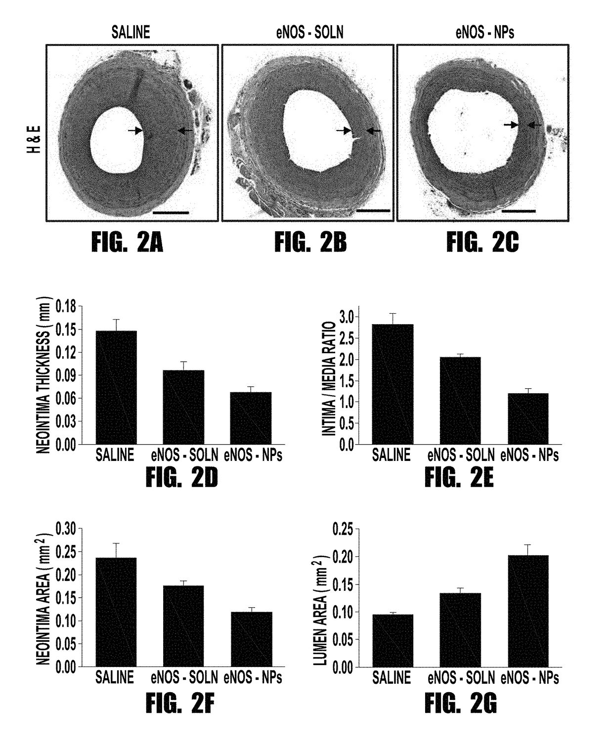 Nitric oxide synthase nanoparticles for treatment of vascular disease