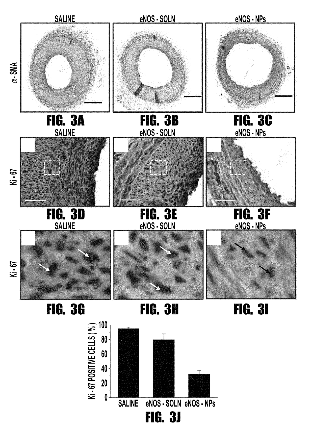 Nitric oxide synthase nanoparticles for treatment of vascular disease