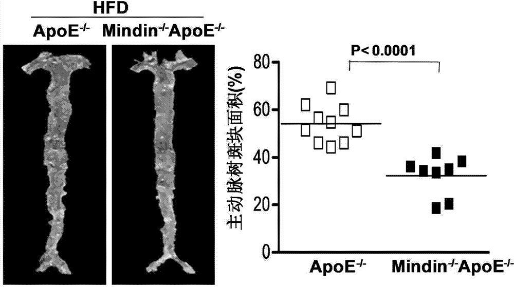 Application of Mindin gene in treatment of atherosclerosis