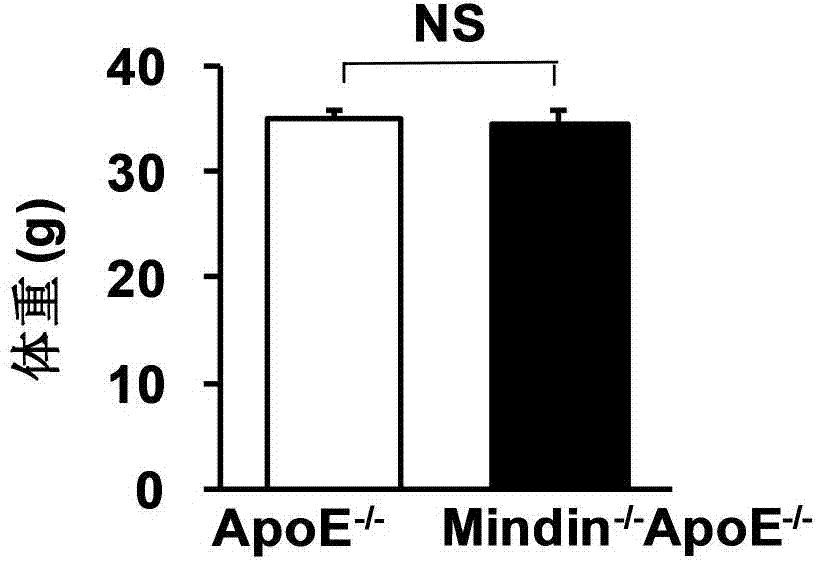 Application of Mindin gene in treatment of atherosclerosis