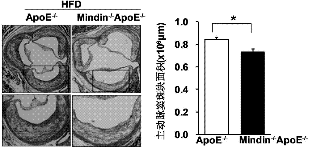 Application of Mindin gene in treatment of atherosclerosis