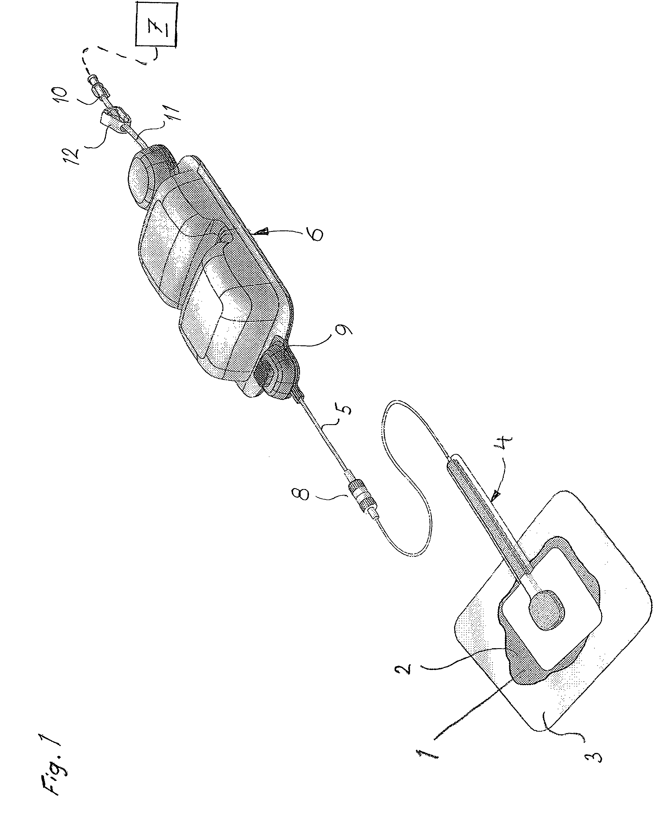 Device for treatment of wound using reduced pressure