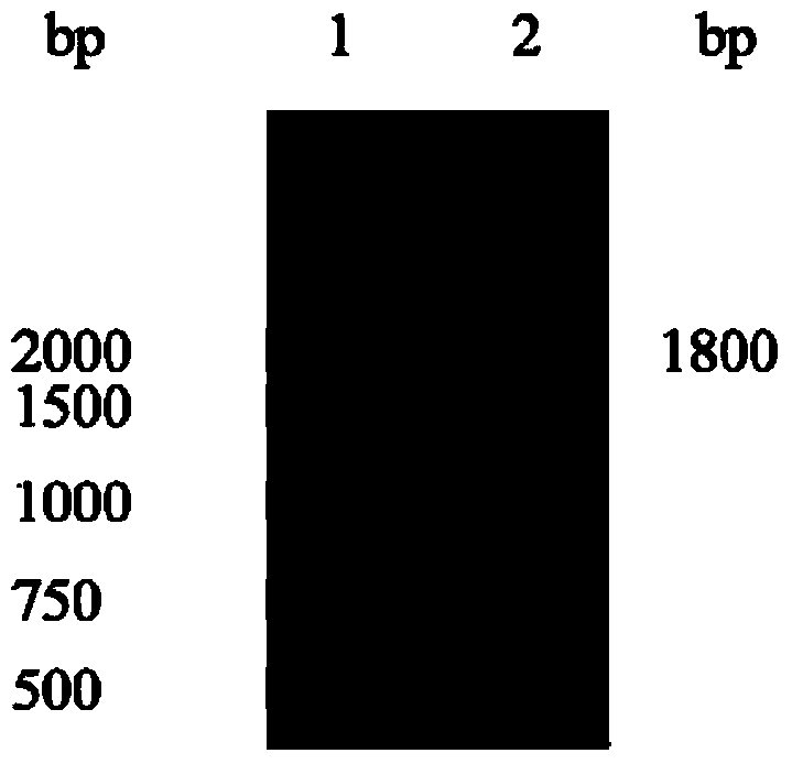 Fusion protein of human vasonatrin peptide and human serum albumin and preparation thereof