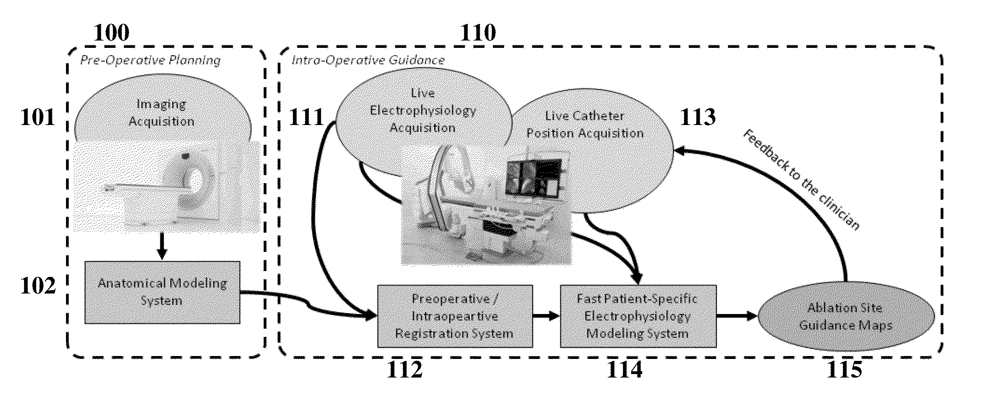 System and Method for Patient Specific Planning and Guidance of Ablative Procedures for Cardiac Arrhythmias