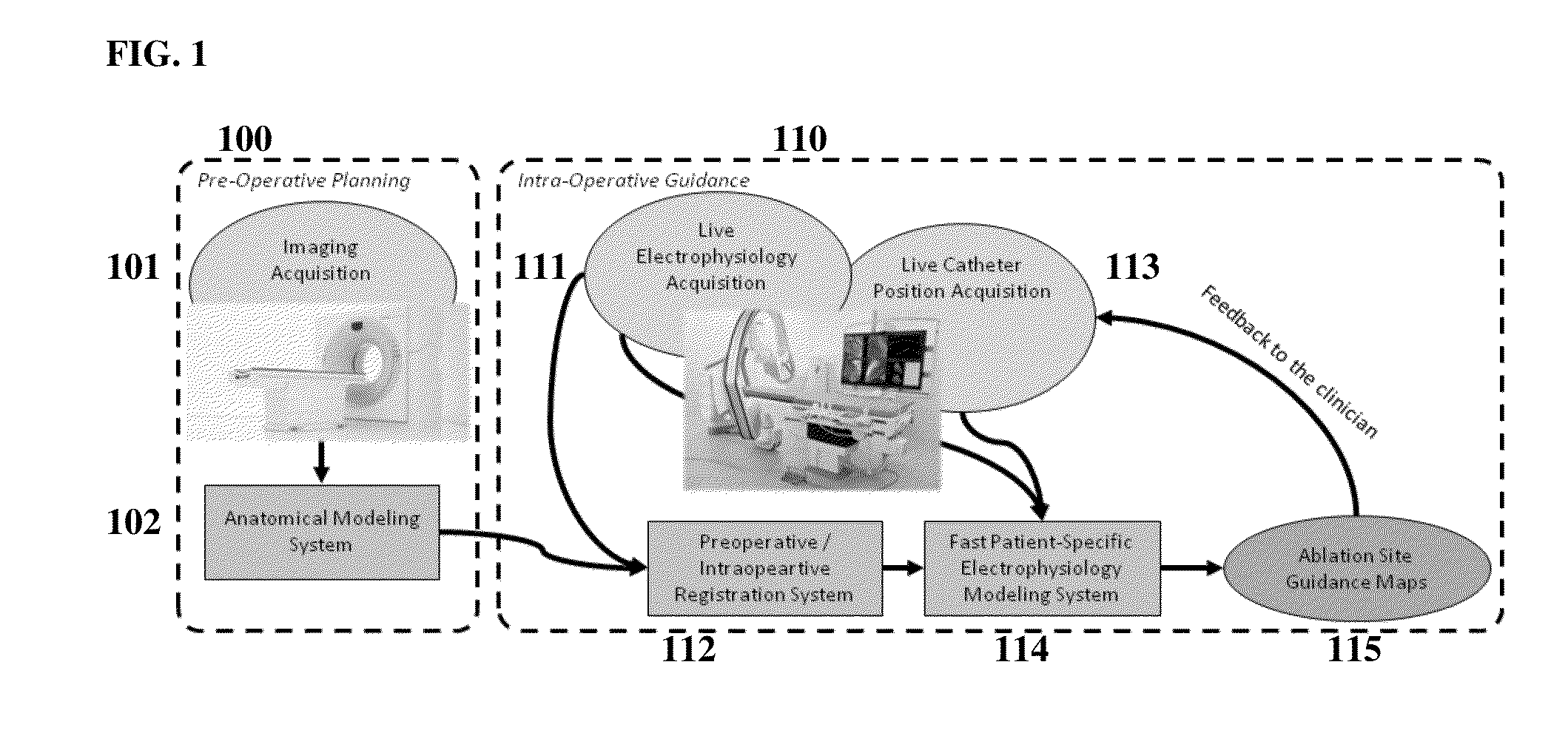 System and Method for Patient Specific Planning and Guidance of Ablative Procedures for Cardiac Arrhythmias