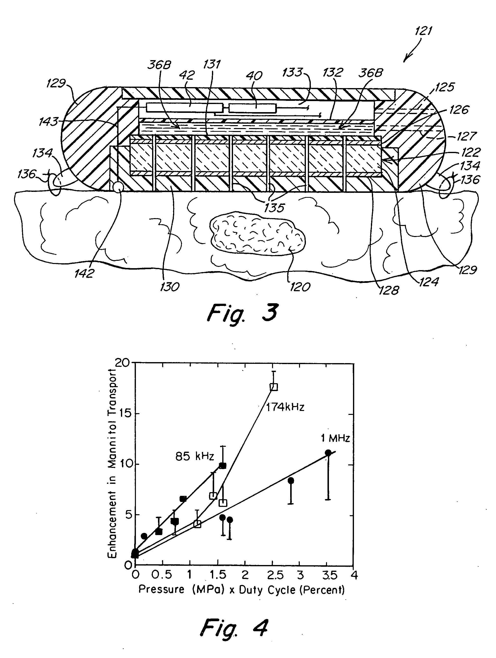Method and apparatus for ultrasonically increasing the transportation of therapeutic substances through tissue