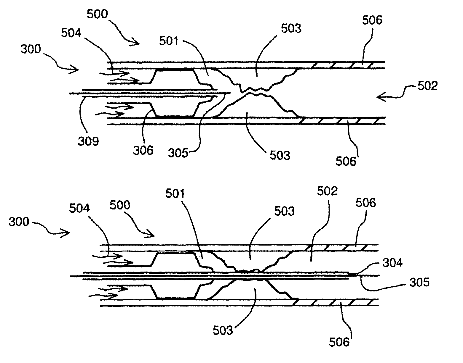 Apparatus to prevent reperfusion injury