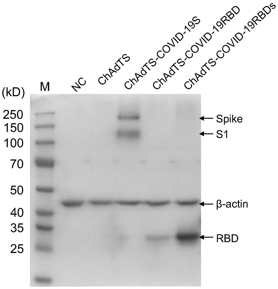 Three recombinant adenoviruses, RBD of SARS-CoV-2 Spike protein and application of three recombinant adenoviruses and RBD of SARS-CoV-2 Spike protein