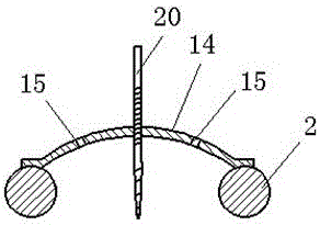 Shank and ankle fracture traction reduction frame