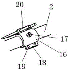 Shank and ankle fracture traction reduction frame