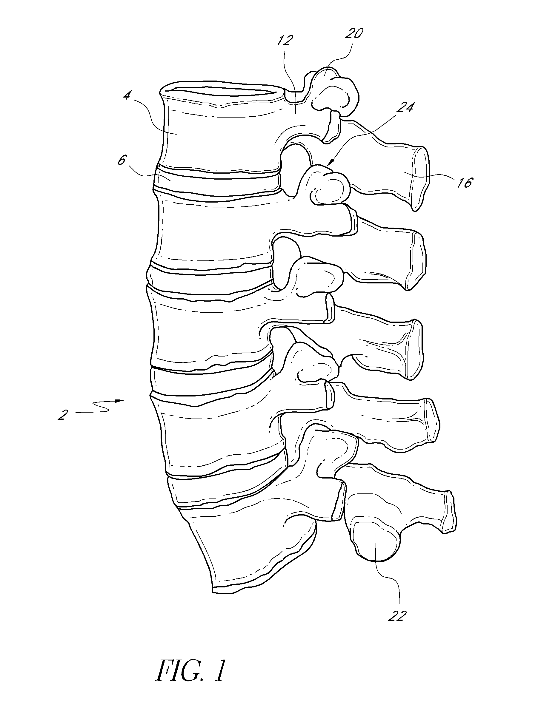 Vertebral facet joint drill and method of use