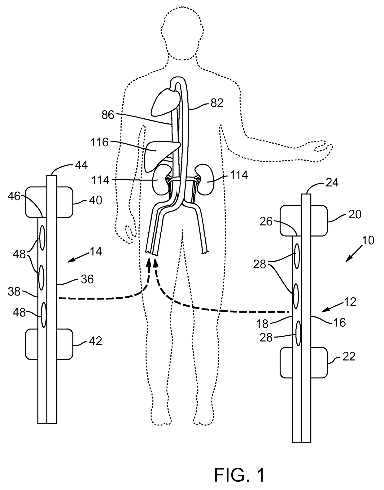 Endovascular apparatus for perfusing organs in a body