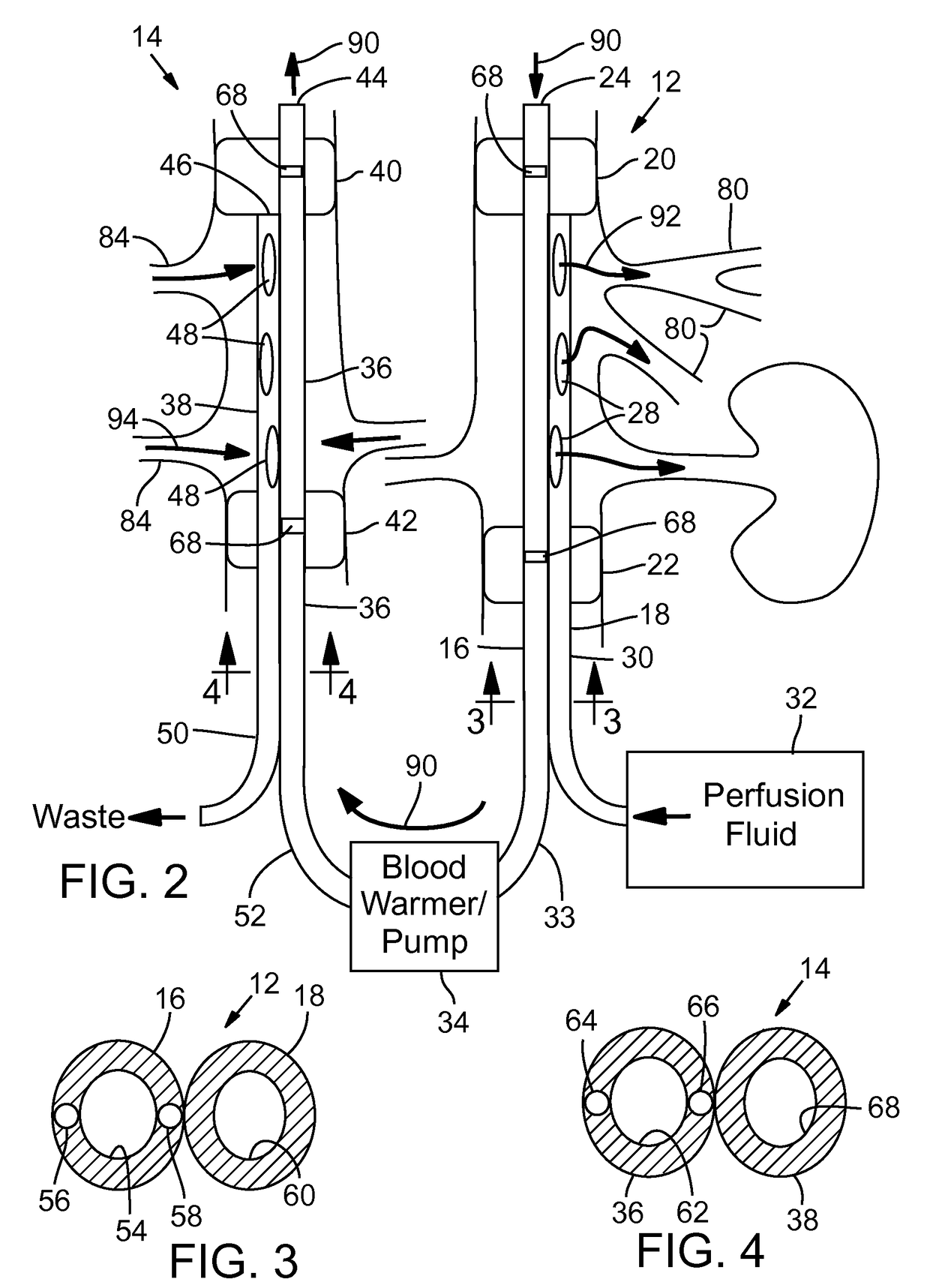 Endovascular apparatus for perfusing organs in a body