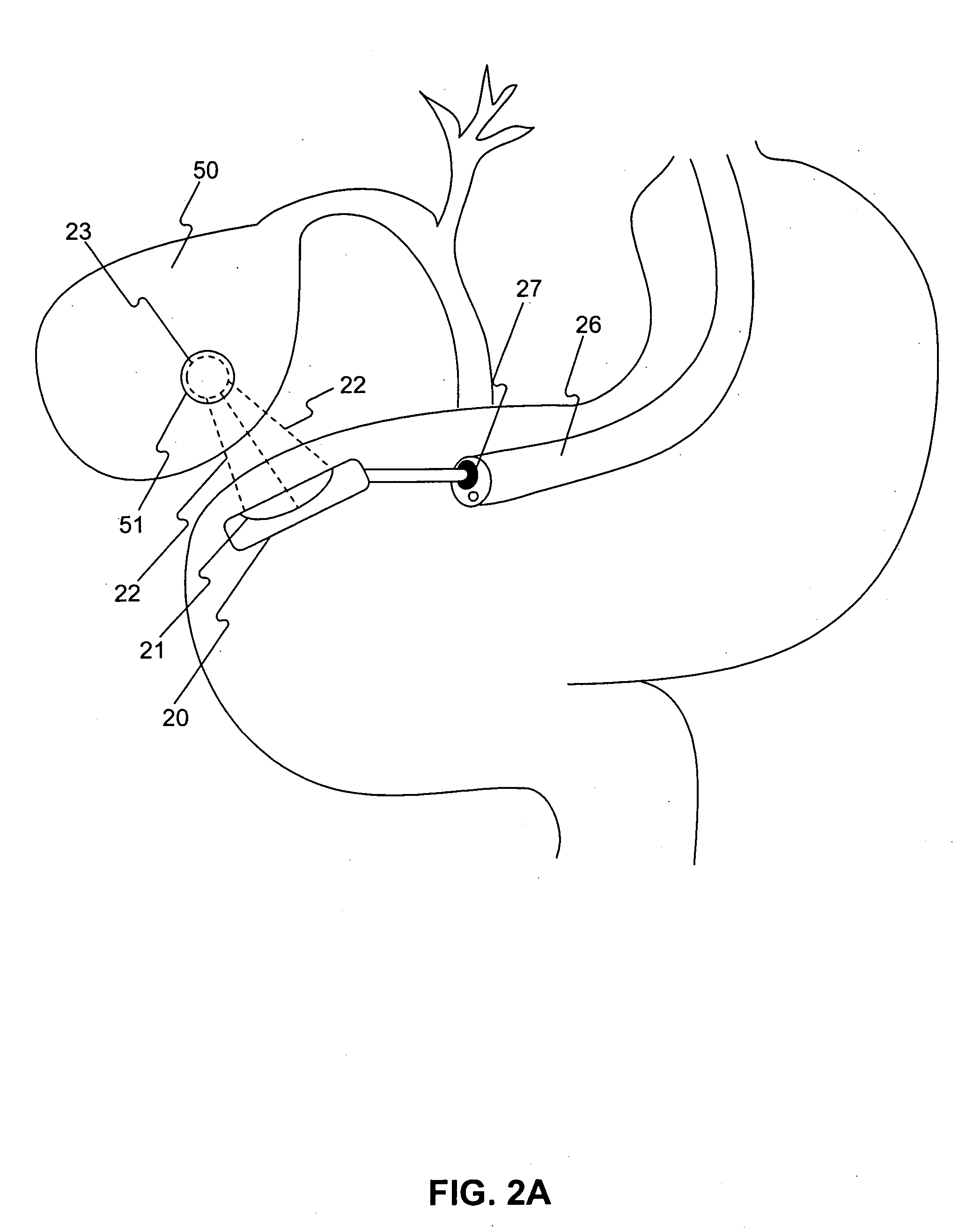 Methods of delivering energy to body portions to produce a therapeutic response