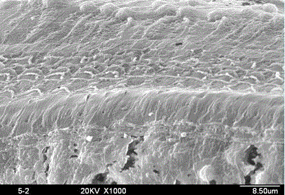 Application in preparation of medicine composition for treating deafness