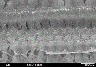 Application in preparation of medicine composition for treating deafness