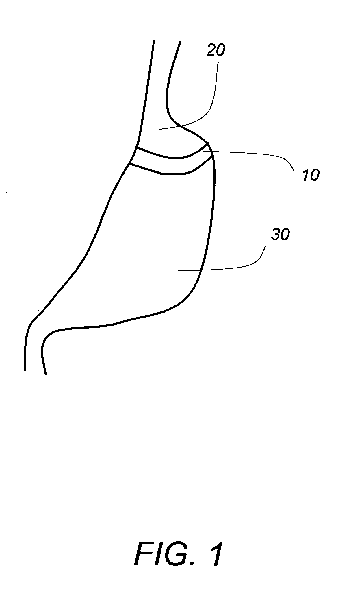 Gastric band insertion instrument