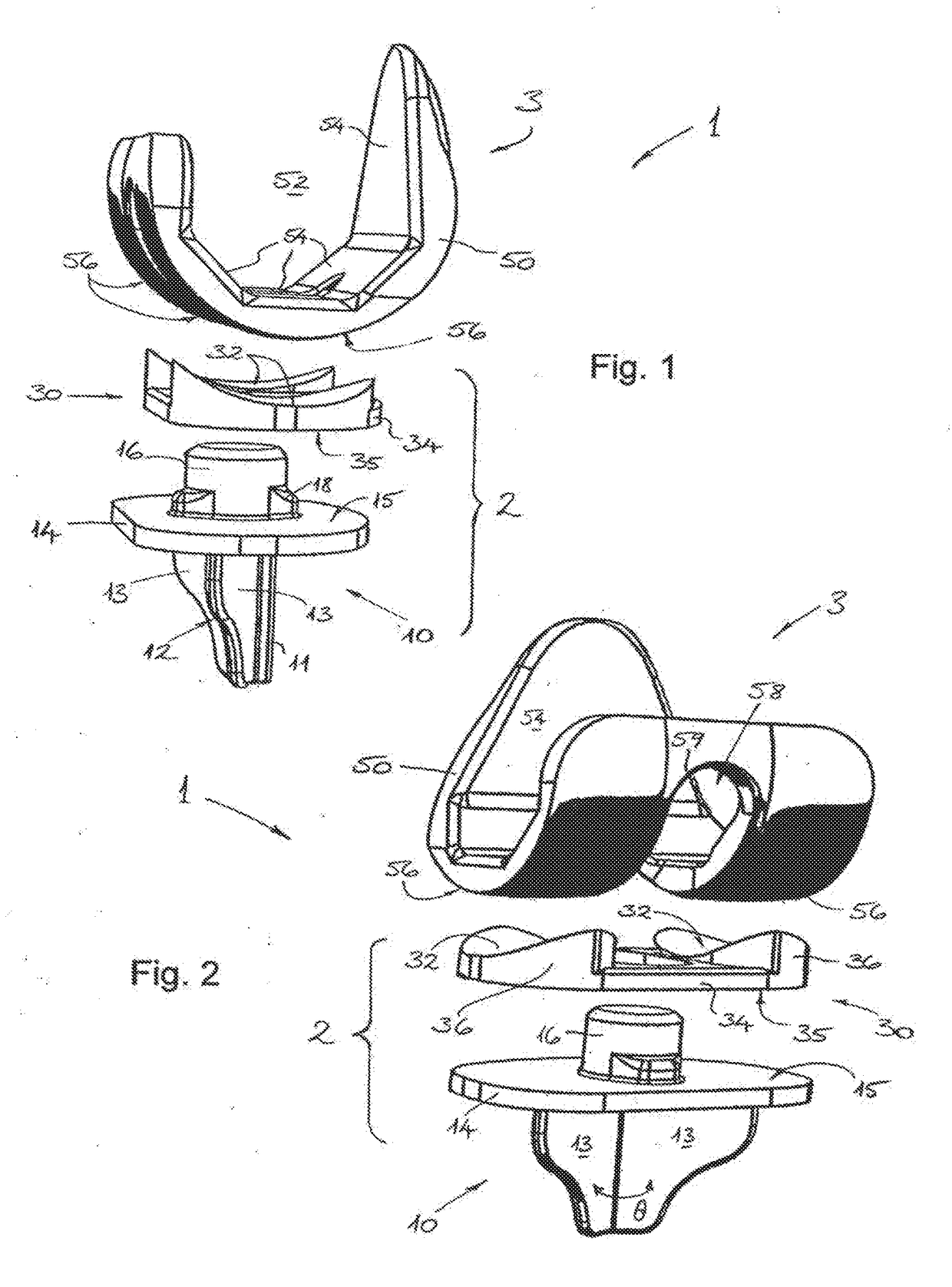 Knee Joint Prosthesis and Related Method