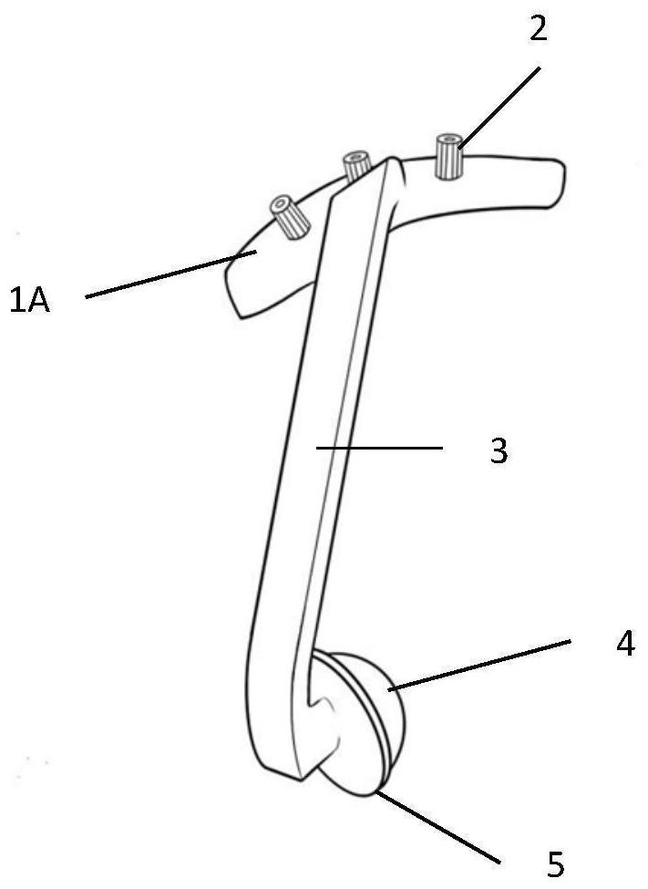 A 3D-printed surgical guide for individualized precise positioning of the acetabulum