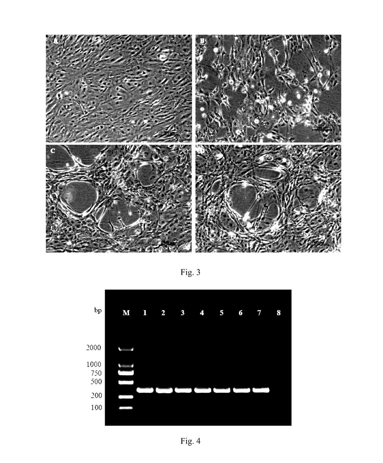 Cyprinid herpesvirus II-sensitive brain tissue cell line of <i>Carassius auratus gibelio </i>and establishing method and use thereof