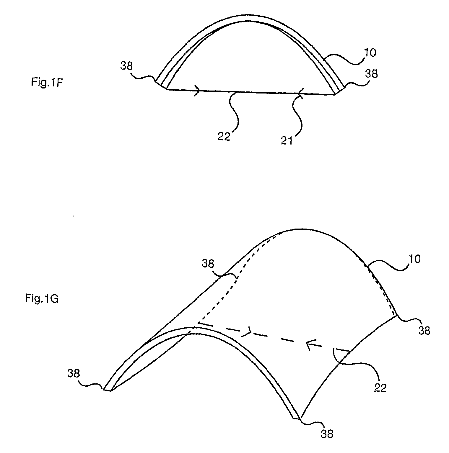 Structural Assembly With a Tied, Flexurally Deformed Panel