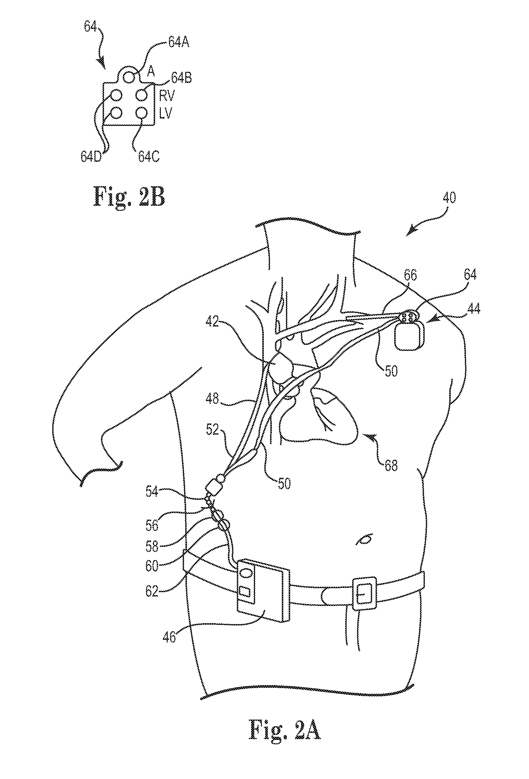 Combination heart assist systems, methods, and devices