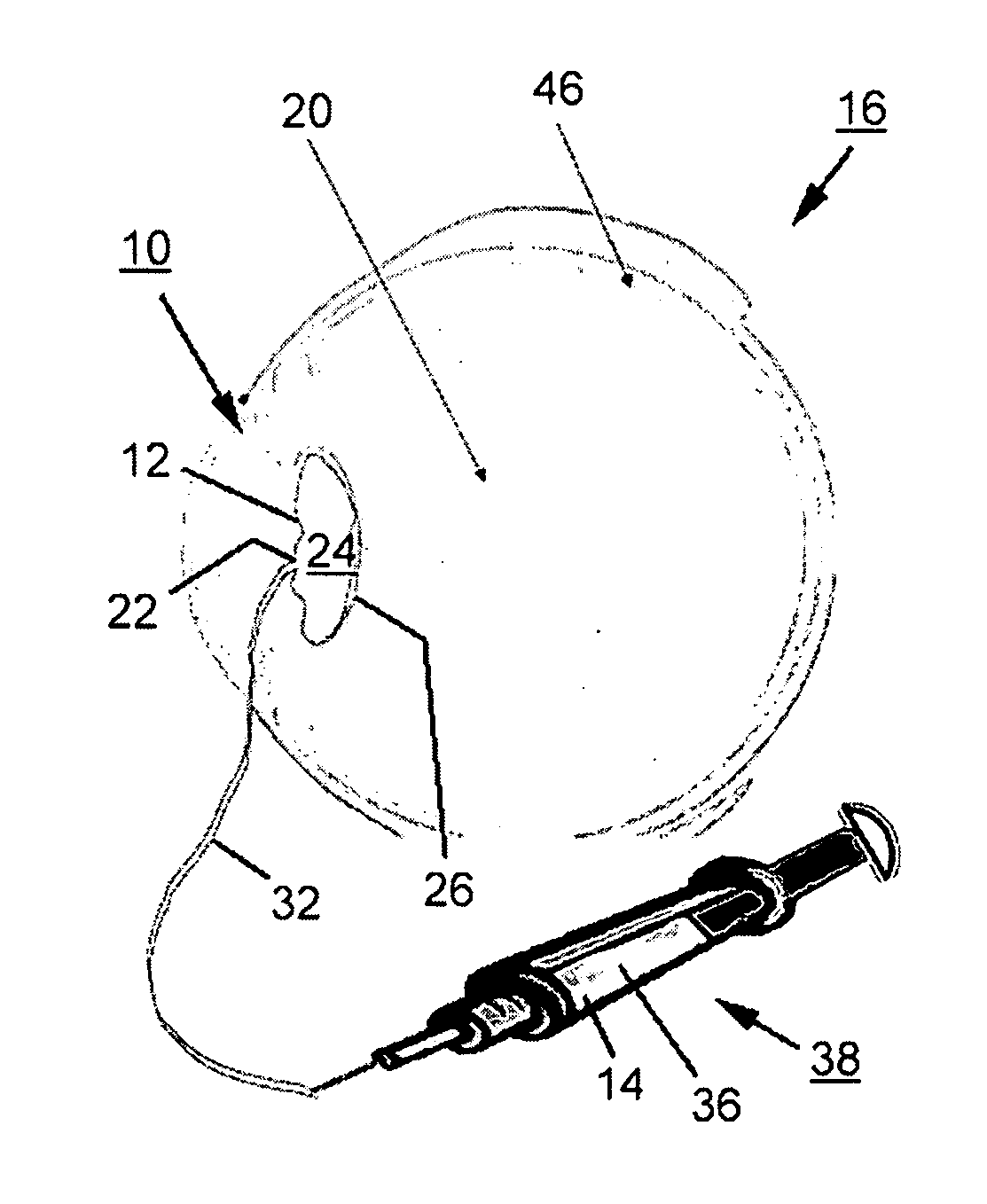 Eye implant and methods of positioning an artificial eye implant within the eye of a human or an animal